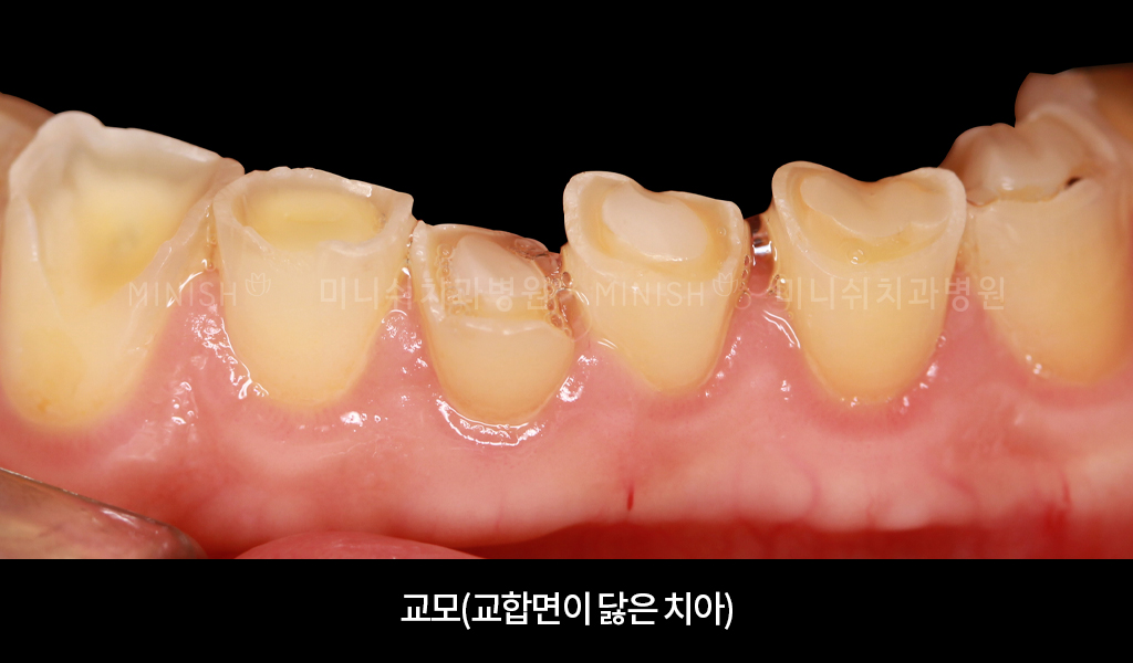 치아가 생겼을 때에는 치아 건강을 잘 관리해야 합니다. 2