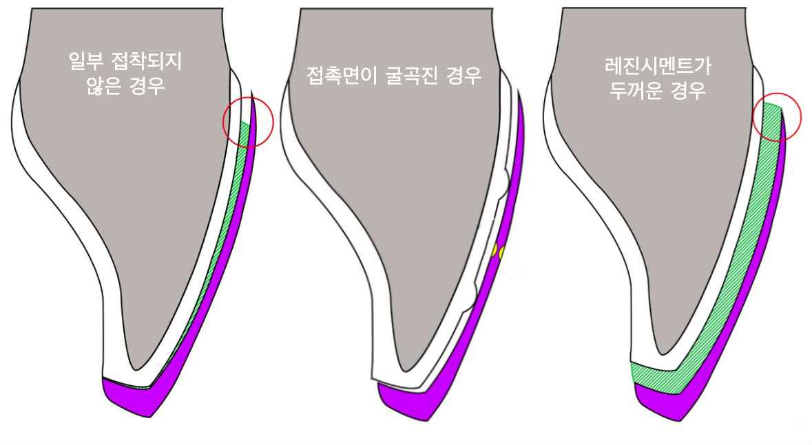 접착.jpg