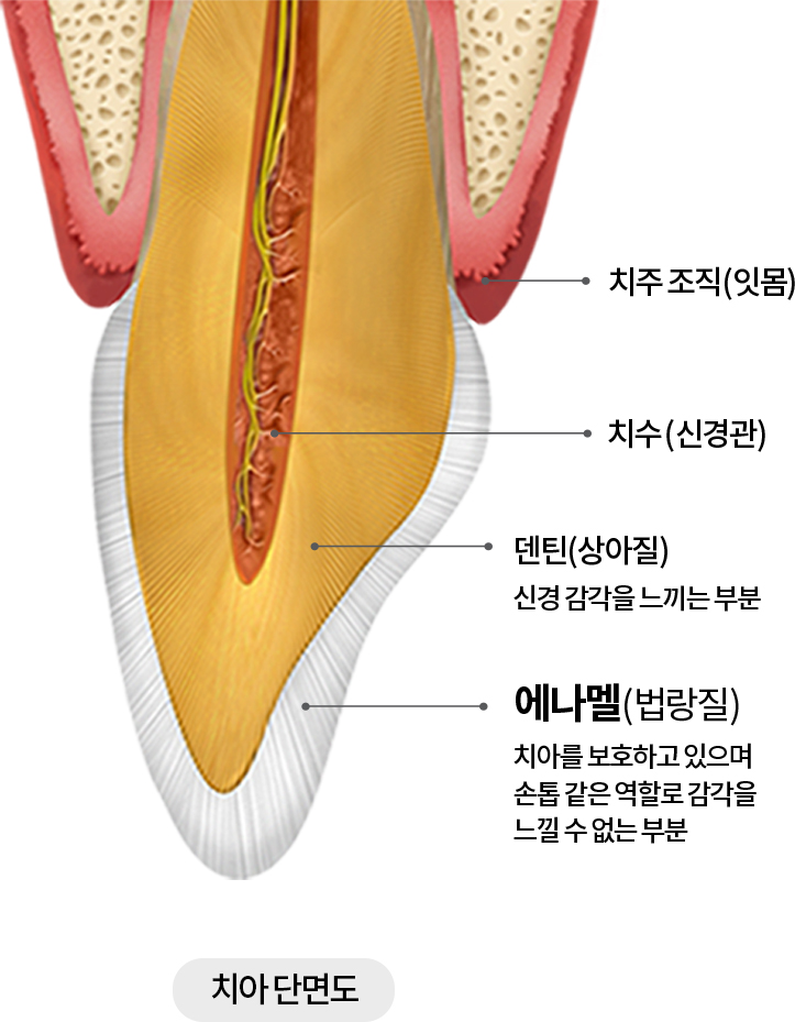 치아 단면도